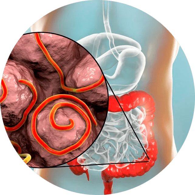 Tractus gastro-intestinal et parasites