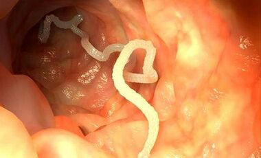 causes des parasites dans le corps humain