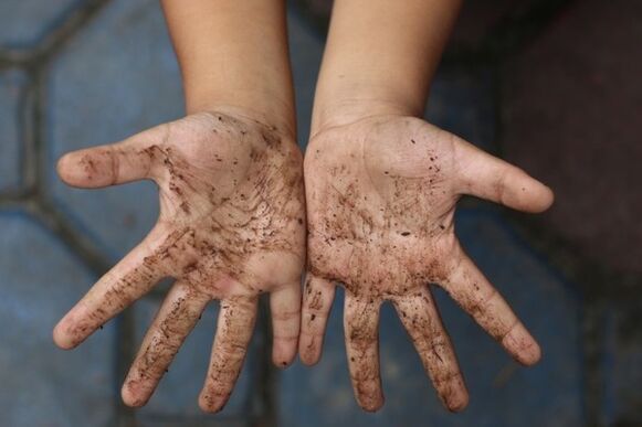 les mains sales comme cause des vers